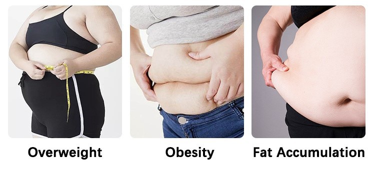 4Are You Anxious About Your Body 4Are You Anxious About Your Body